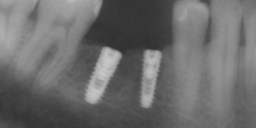 Стоматология Зильберс