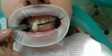 Стоматология Зильберс