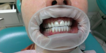 Стоматология Зильберс