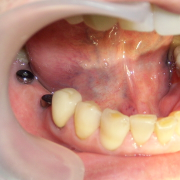 Стоматология Зильберс