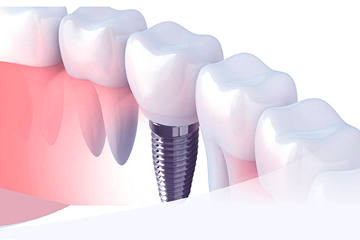 Стоматология Зильберс