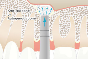 Стоматология Зильберс