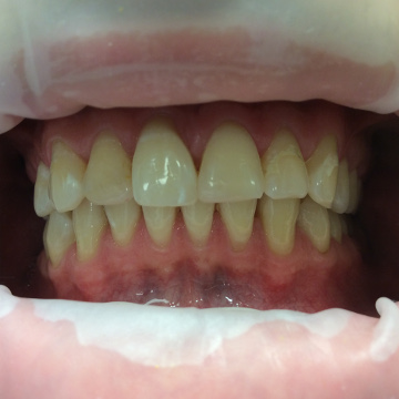 Стоматология Зильберс