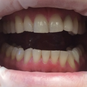 Стоматология Зильберс