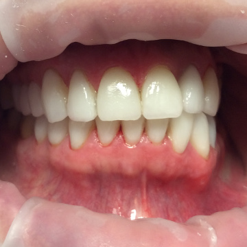 Стоматология Зильберс