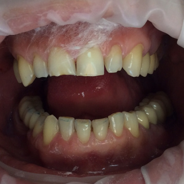 Стоматология Зильберс