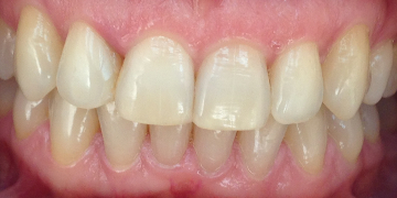 Стоматология Зильберс