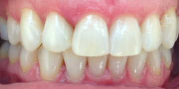 Стоматология Зильберс