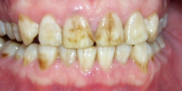 Стоматология Зильберс