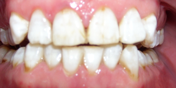 Стоматология Зильберс