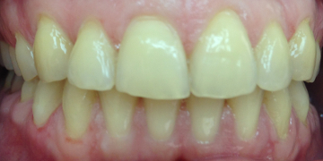 Стоматология Зильберс