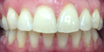 Стоматология Зильберс